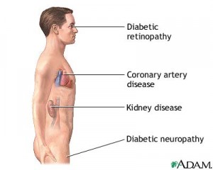 Long term complications of diabetes if blood sugar levels are not kept under control