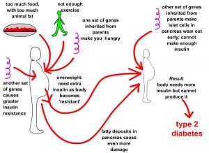 Type 2 diabetes causes